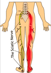 Sciatic Nerve