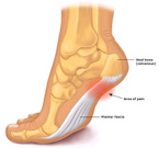 Plantar Fascia