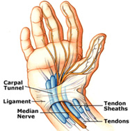 Carpal Tunnel